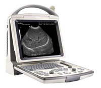 DP-30 黑白便携式超声诊断系统