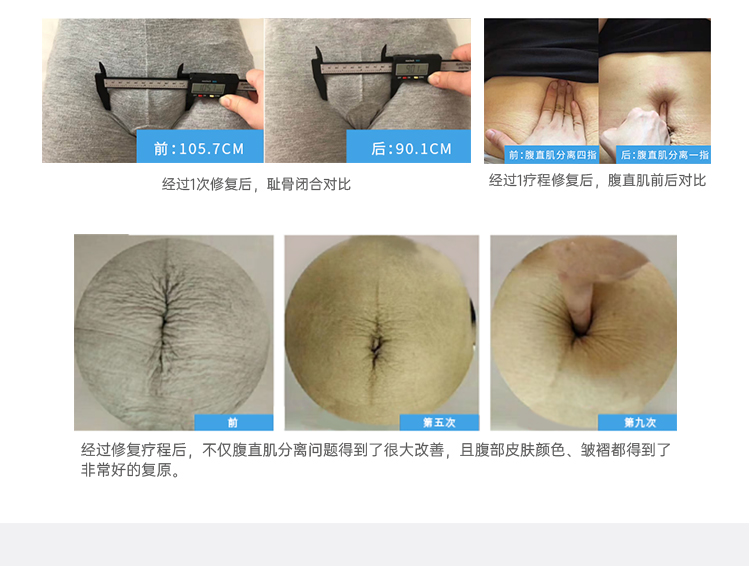 1617879319993729.jpg 盆底康复治疗仪