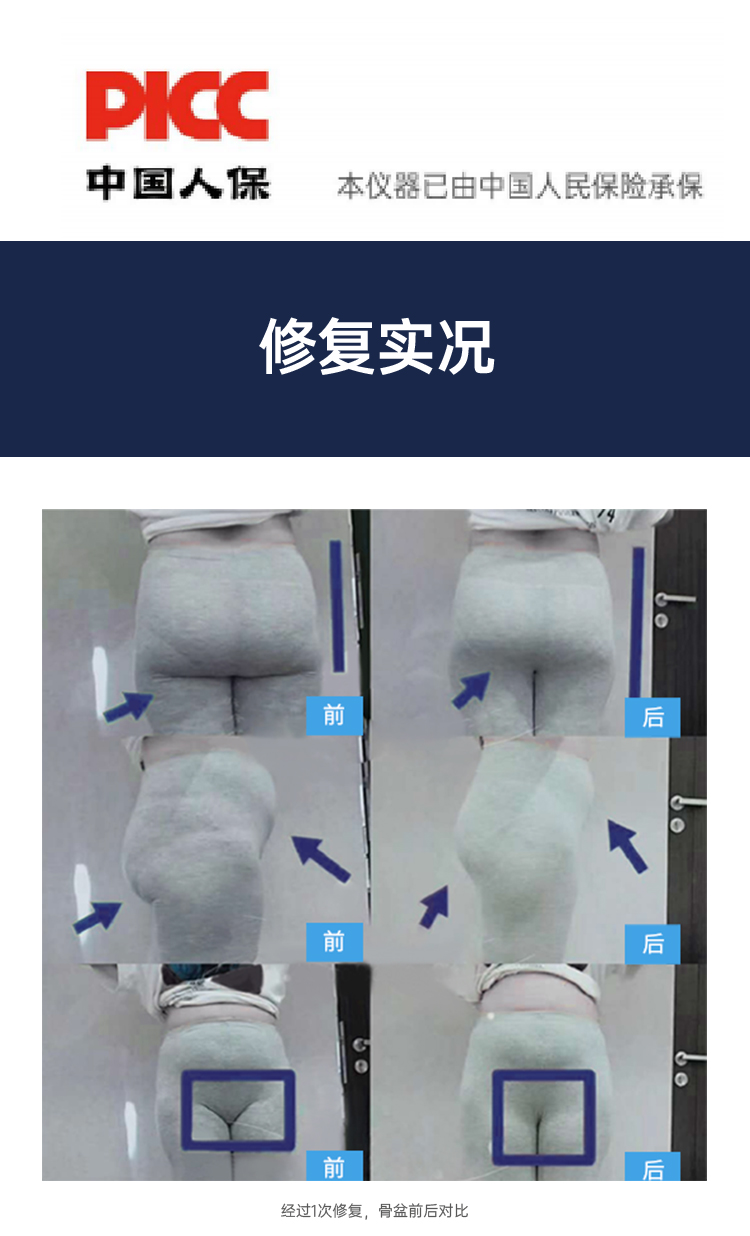 1617879319202223.jpg 盆底康复治疗仪